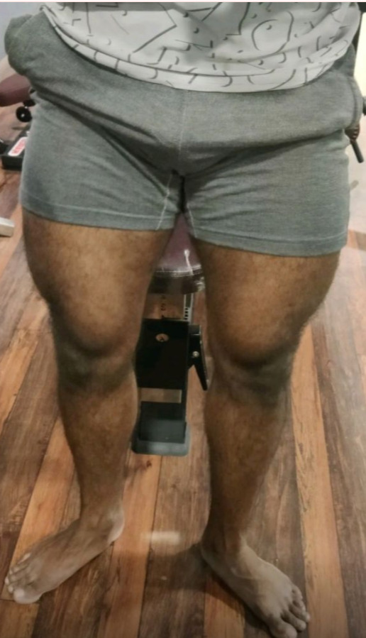 Mallu 2